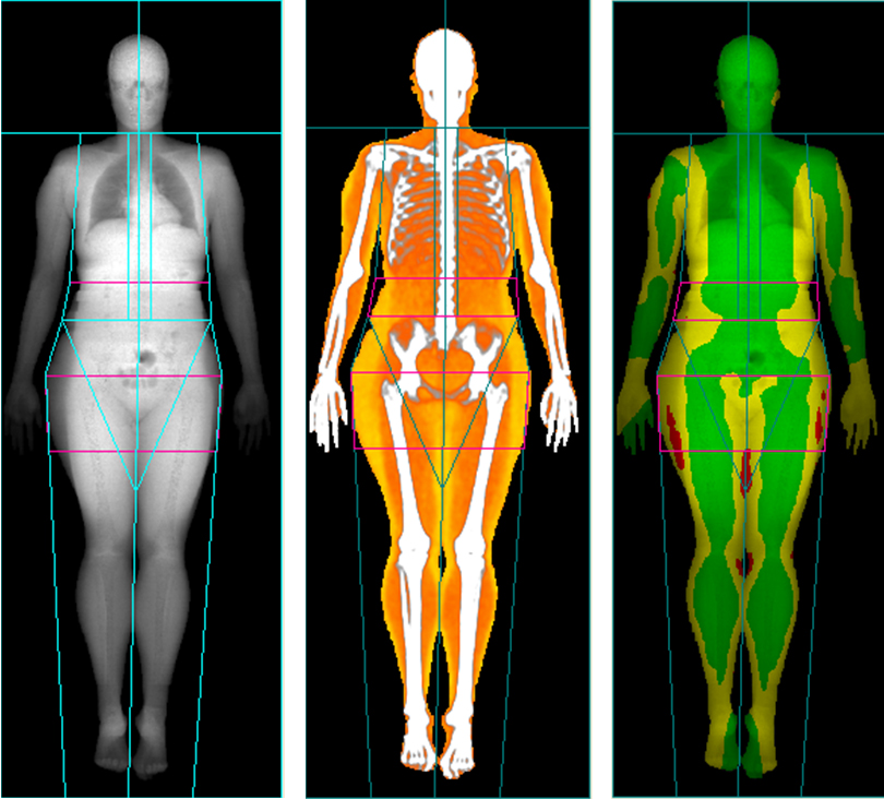 Advanced Body Composition Scans – AR Bone Health LLC